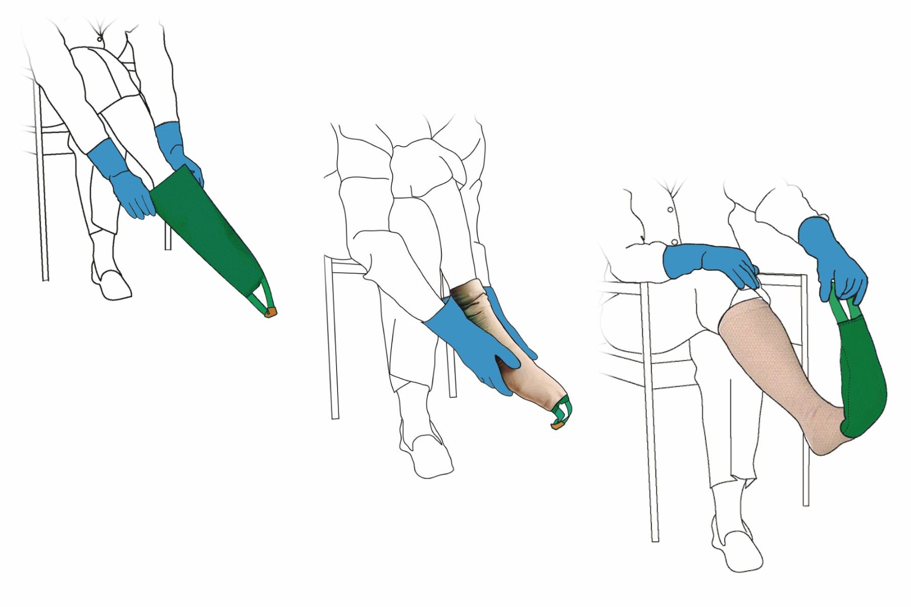 Arion Easy-Slide Hosiery Application Aid for Open Toe Stockings