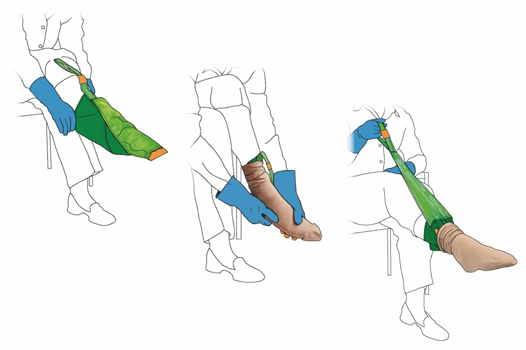 Arion Magnide&reg; Hosiery Application Aid For Open/Closed Toe Stockings